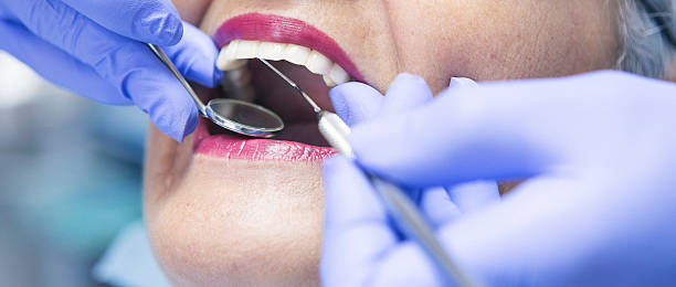 Best Walk-In Emergency Dentist in Washington, IA